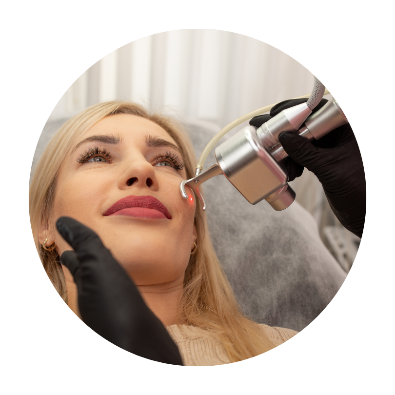 Fractional RF CO2 Laser Skin Tightening Skin Resurfacing Beauty Machine